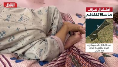الجوع والمرض.. واقع أطفال غزة المأساوي