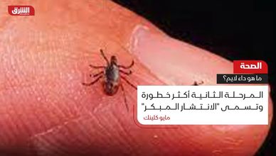 الصحة.. ما هو داء لايم؟