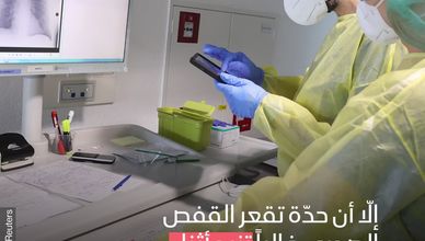 الصدر المقعر