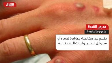 جدري القردة.. ما هو وما أعراضه؟