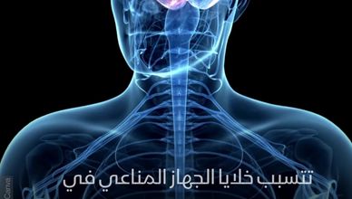 ما أعراض داء "هاشيموتو"؟