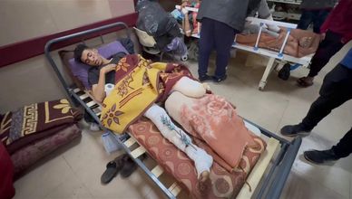 معاناة كبيرة يعيشها آلاف من مبتوري الأطراف في غزة بسبب الحرب