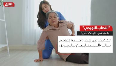"التصلب اللويحي".. دراسة تمهد لأبحاث علاجية