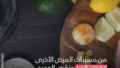 فقر الدم الناجم عن نقص الحديد