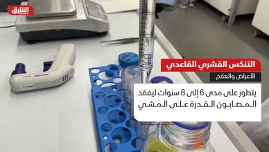 التنكس القشري القاعدي.. الأعراض والعلاج