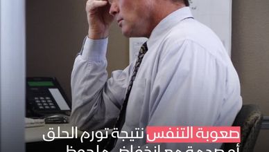 حساسية الصويا