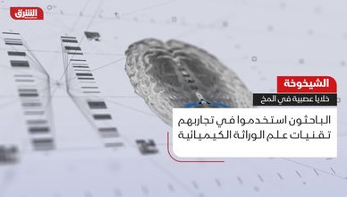 الشيخوخة.. خلايا عصبية في المخ