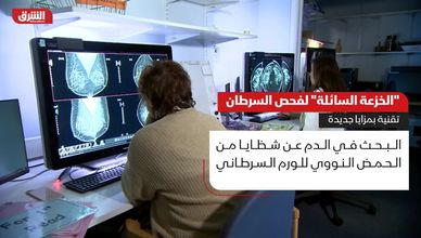 "الخزعة السائلة" لفحص السرطان.. تقنية بمزايا جديدة
