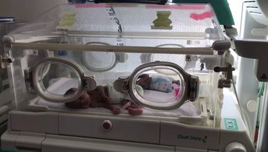 أليكس سايح: 10 من أطفال غزة يفقدون جزءا من أجسادهم يوميا