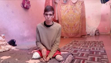 أوضاع مبتوري الأطراف في غزة.. مأساة المدنيين تمتد لما بعد الهدنة