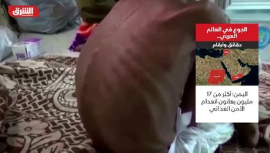 الجوع في العالم العربي.. حقائق وأرقام