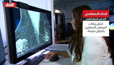 الذكاء الاصطناعي.. تقنيات ذكية تتنبئ بالأمراض وتخفض التكاليف