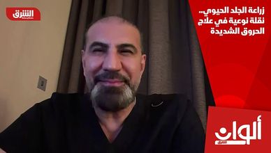 زراعة الجلد الحيوي.. نقلة نوعية في علاج الحروق الشديدة