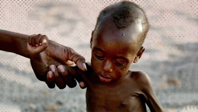 السودان.. جوع وأمراض وسط انهيار القطاع الصحي