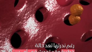 فقر الدم اللاتنسجي