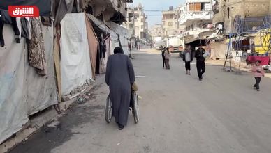 أوضاع مبتوري الأطراف في غزة.. مأساة المدنيين تمتد لما بعد الهدنة