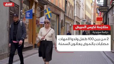 متلازمة تكيس المبيض.. دراسة سويدية