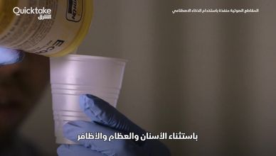 مفتاح المستقبل.. جل طبي لزرع الإلكترونيات داخلنا