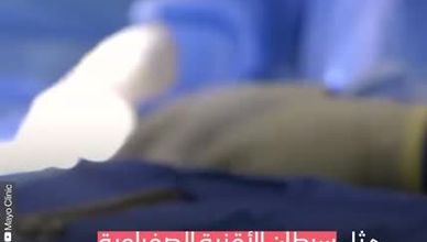 سرطان الكبد