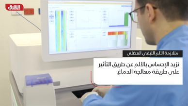 متلازمة الألم الليفي العضلي