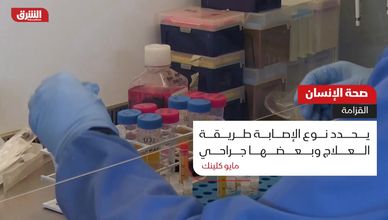 صحة الإنسان.. القزامة