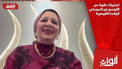 تحذيرات طبية من التوسع غير المبرر في الولادة القيصرية