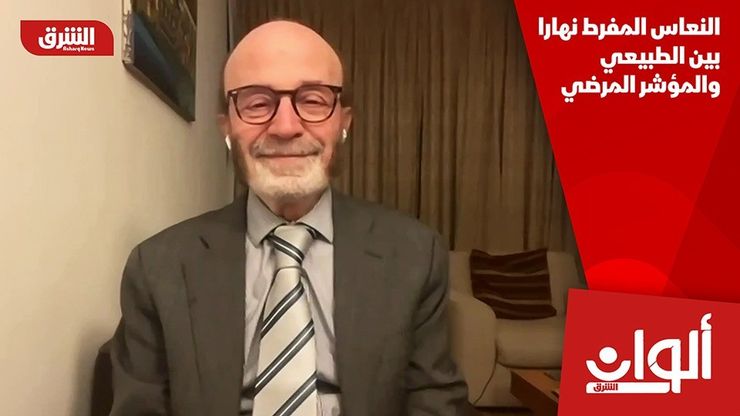 النعاس المفرط نهارا بين الطبيعي والمؤشر المرضي