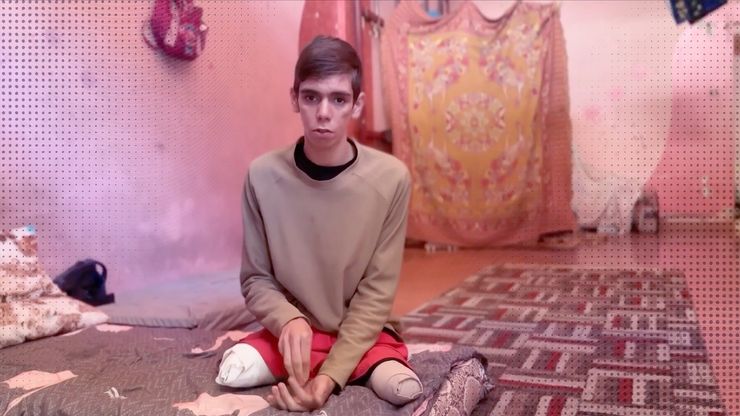 أوضاع مبتوري الأطراف في غزة.. مأساة المدنيين تمتد لما بعد الهدنة