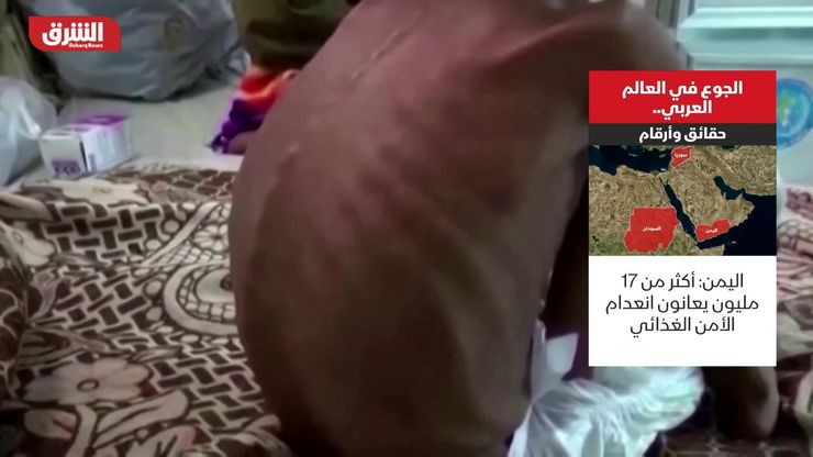 الجوع في العالم العربي.. حقائق وأرقام