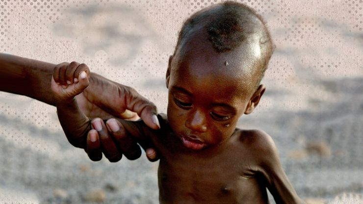 السودان.. جوع وأمراض وسط انهيار القطاع الصحي