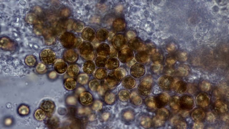 صراع الأعماق